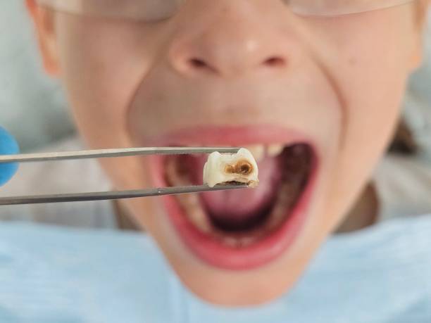 Best After-Hours Emergency Dentist in Morgantown, IN